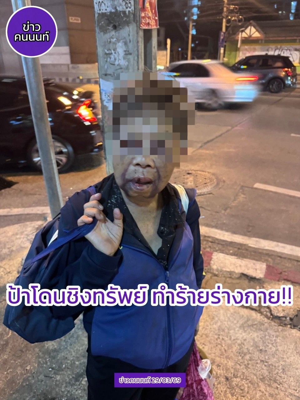 โครตหดหู่ใจ ป้าถูกทำร้ายร่างกาย และ ชิงทรัพย์ ตามใบหน้ามีแต่รอยบวมช้ำ